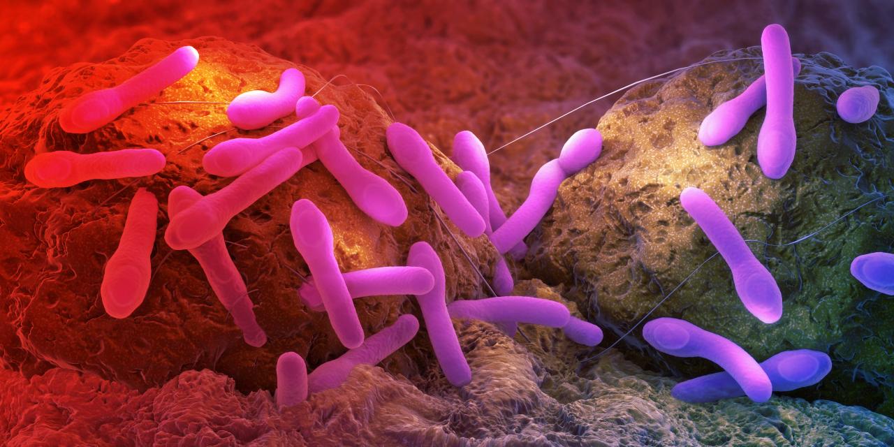 A botulizmus-riadó az anyatejpótlóknál: veszélyben a csecsemők?