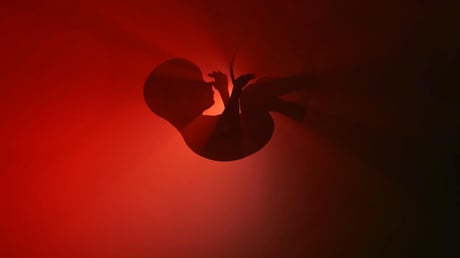 A népszerű epilepszia-gyógyszer súlyosan árthat a magzatoknak