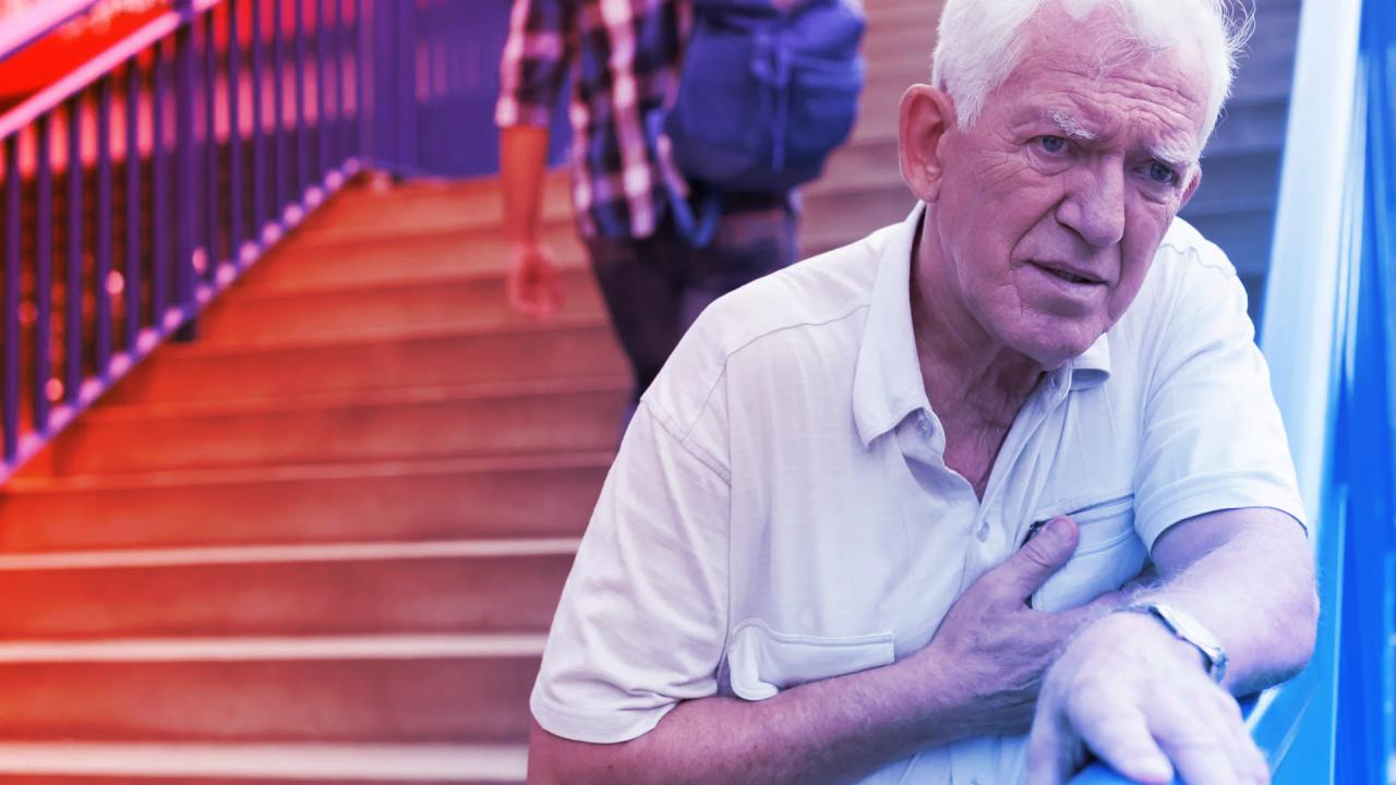 A szívinfarktusok felét tévesen alacsony kockázatúnak sorolják