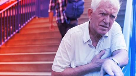 A szívinfarktusok felét tévesen alacsony kockázatúnak sorolják