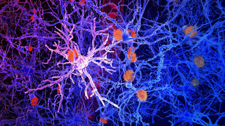 Az agy immunsejtjei segíthetnek megállítani az Alzheimer-kórt