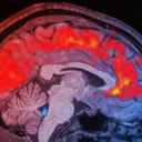 Az agy leáll: miért kapcsolsz le, ha kialvatlan vagy?