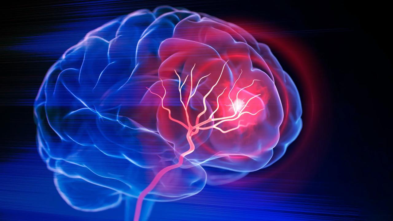 Az agyad sérül, mielőtt a vérnyomásod megugrana