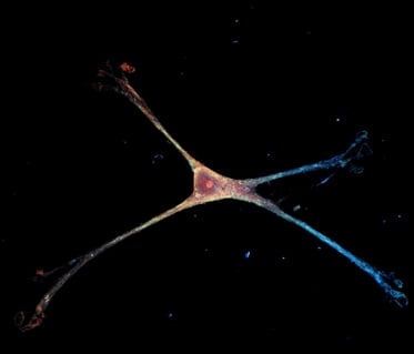 Az agykutatás új sztárjai: végre láthatjuk az igazi asztrocitákat