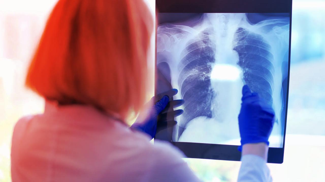 Az állandó fáradtság mögött rejtett légzészavar állhat