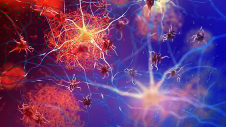 Az Alzheimer-kutatás áttörését egy brazil molekula hozhatja el