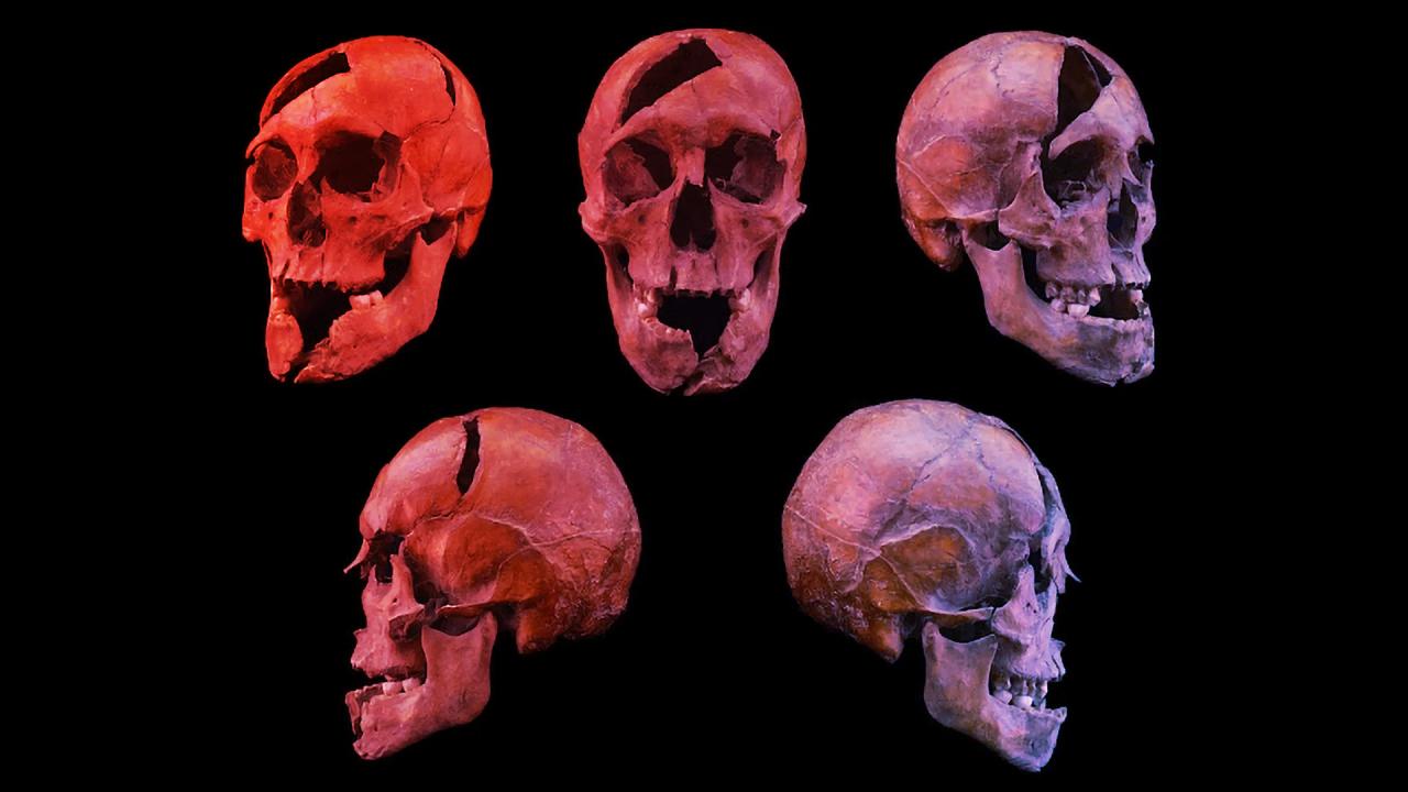 Az Aranyvér bosszúja: Egy 700 éves királyi gyilkosság megfejtve