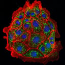 Az áttörés küszöbén? Akut vesekárosodást fordítottak vissza egerekben