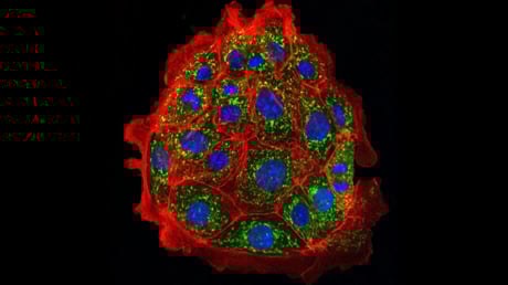 Az áttörés küszöbén? Akut vesekárosodást fordítottak vissza egerekben