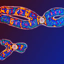Az ikertestvére vére keringett a nő ereiben