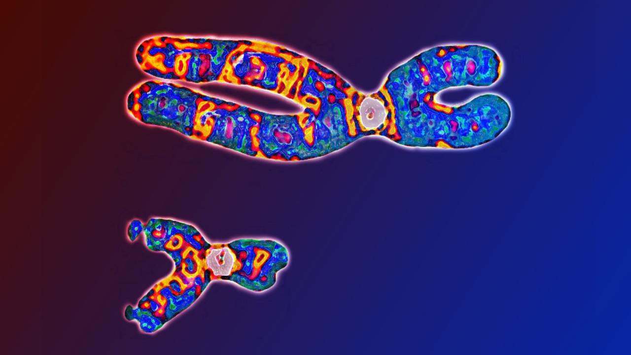 Az ikertestvére vére keringett a nő ereiben