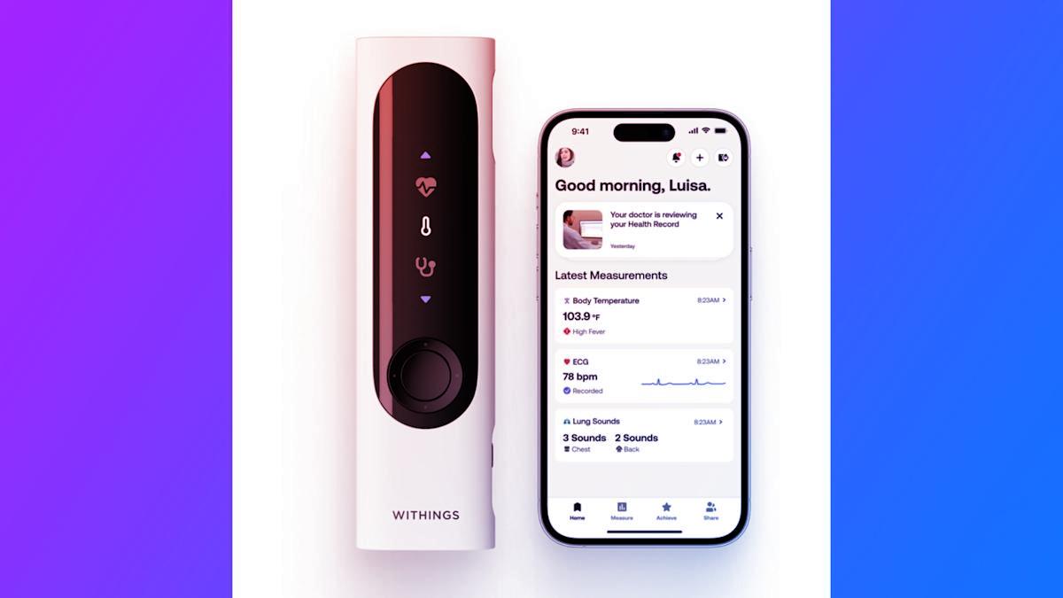 Az okoseszköz, amellyel otthon szinte szakorvos lehetsz