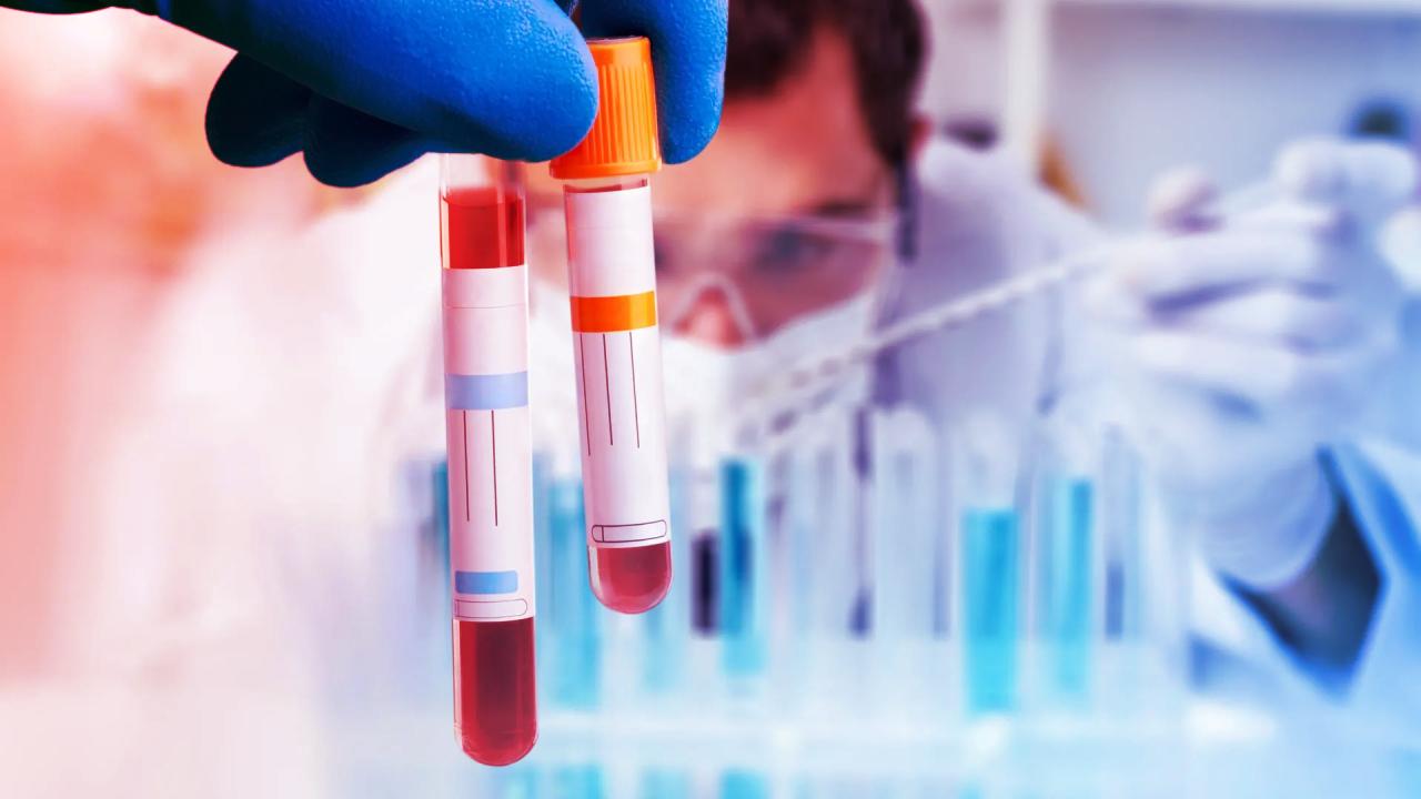 Egy új vérteszt végre igazolja a krónikus fáradtság szindrómát