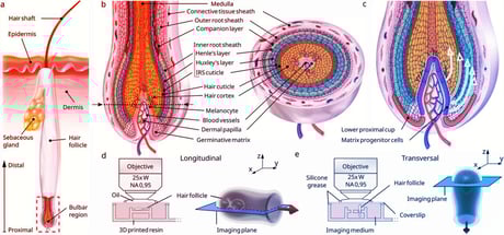 A haj nem nő: láthatatlan erő húzza felfelé
