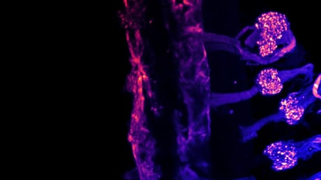 A testünk két úton érzékeli a hideget