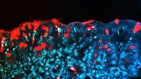 Az adalékok csendes támadása: veszélyben a gyerekeink jövője