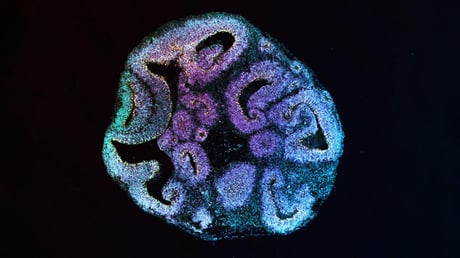 Az agyfejlődés titka: egyetlen génhiba mindent felborít