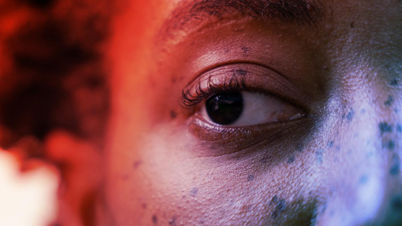 Az altatóinjekció áttörést hozhat a tompalátás gyógyításában