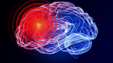 Az apró peptid, ami forradalmasíthatja a fejsérülések kezelését