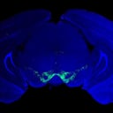 Az áttörés, amely forradalmasítja a Parkinson-kór kezelését