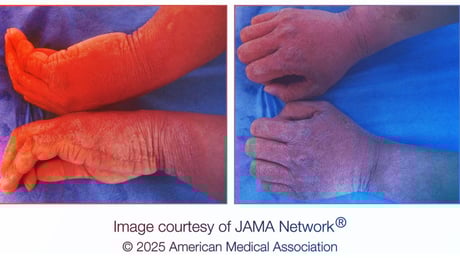 Az ember, akinek mosás után pikkelyesedik a keze