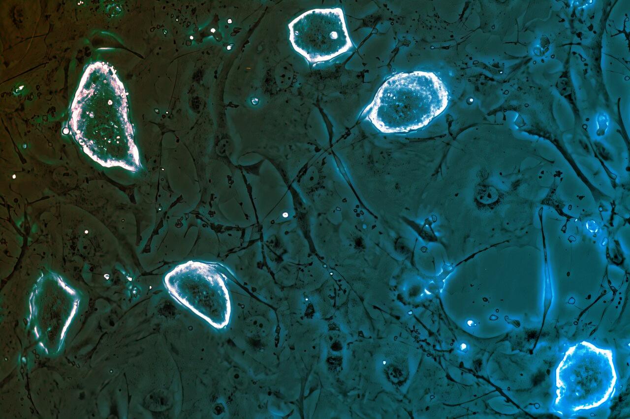 Az emlősök rákellenes trükkje: a szüneteltethető terhesség?