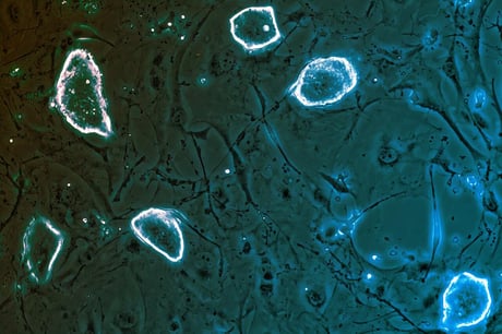Az emlősök rákellenes trükkje: a szüneteltethető terhesség?