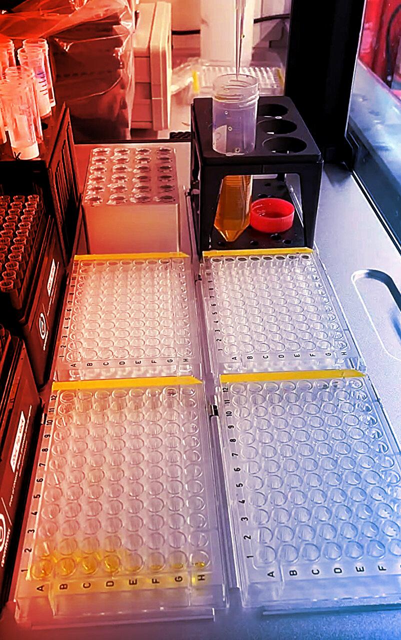 Az MI-vezérelt robotok véletlenül új antibiotikumot fedeztek fel