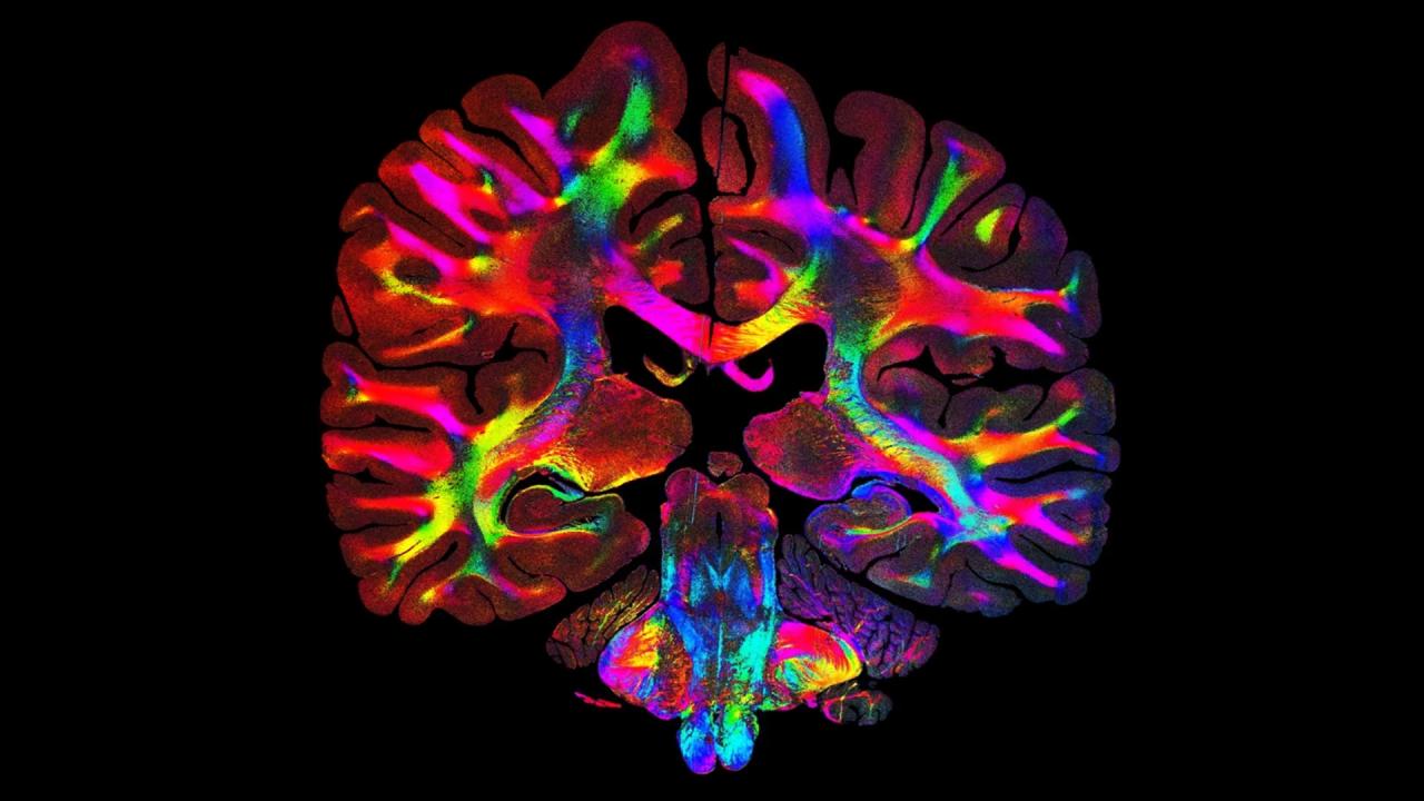 Az új fénytechnika feltárja az agy titkos ösvényeit