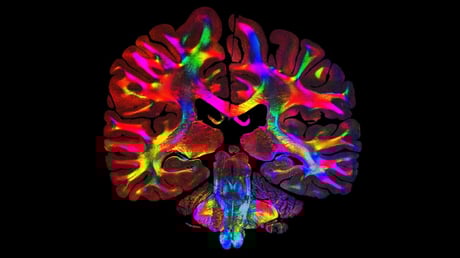 Az új fénytechnika feltárja az agy titkos ösvényeit