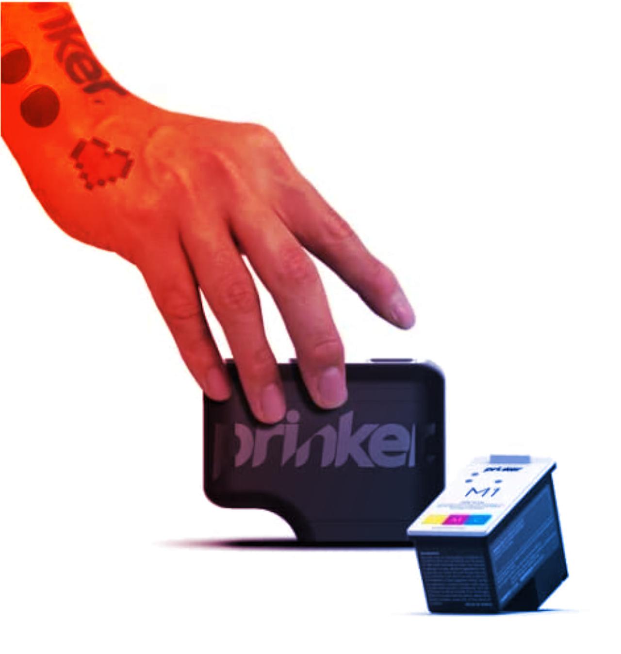 Villámgyors tetkó otthon: Prinker M teszt