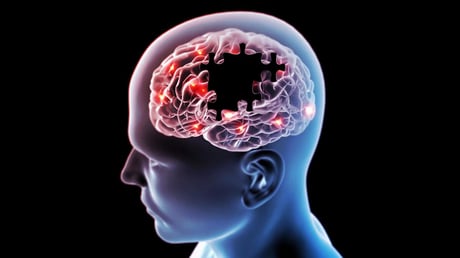 A Parkinson-kór új gyenge pontja: lelepleztek egy rejtett fehérjét