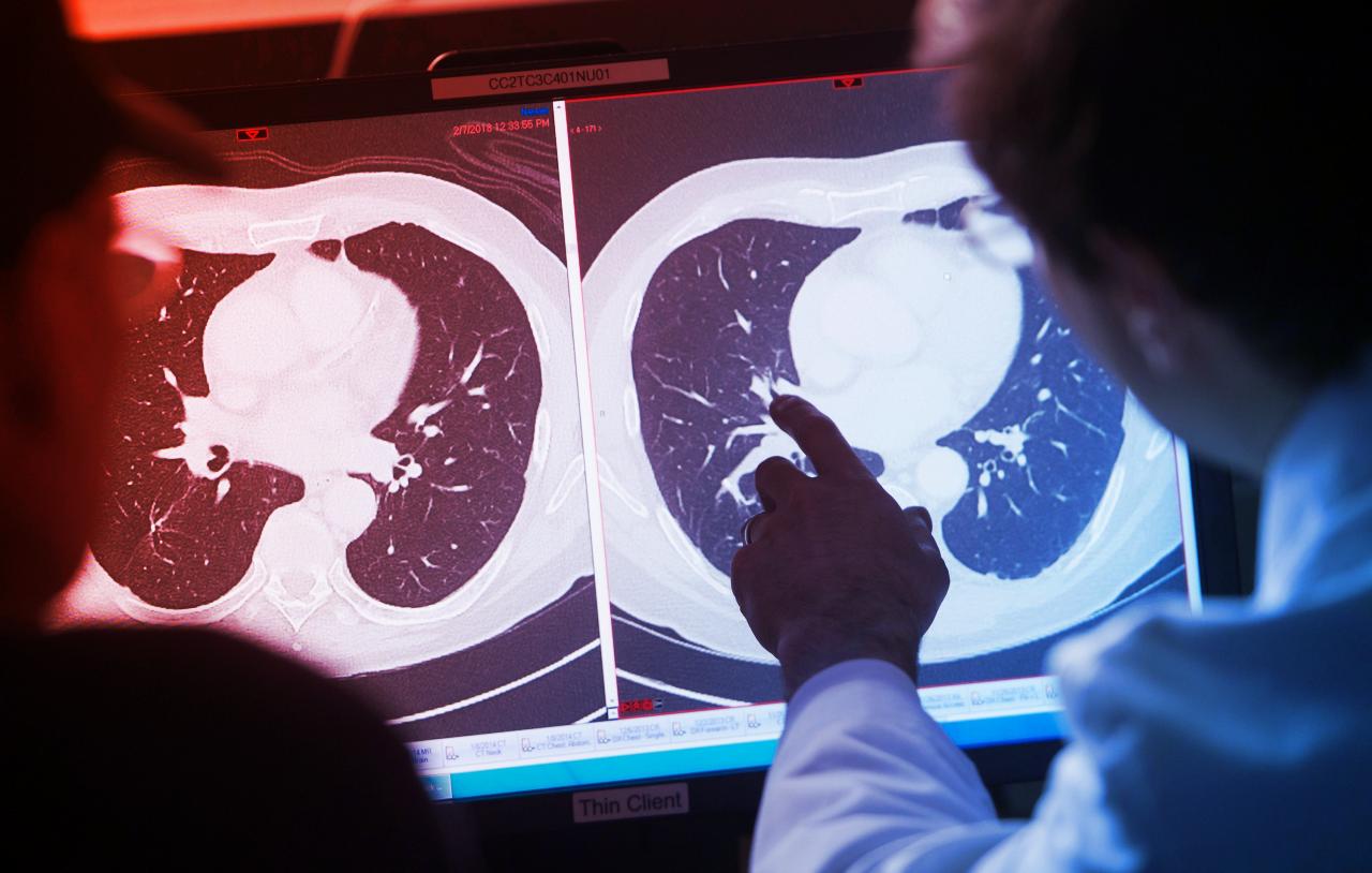 A rákbetegek 70 százaléka már öt évnél tovább él Amerikában