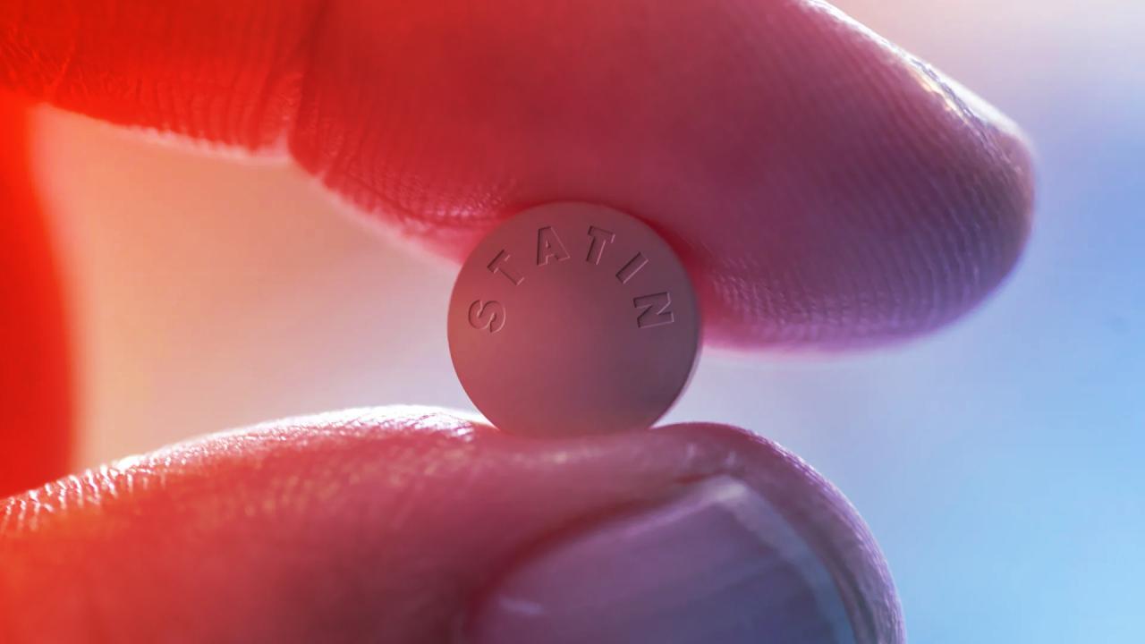 A sztatinok sötét oldala: miért fájhat tőlük az izom?