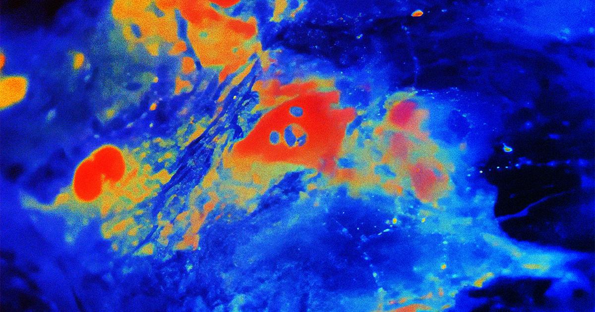 Az agy láthatatlan főnökei: az asztrociták rejtett hatalma