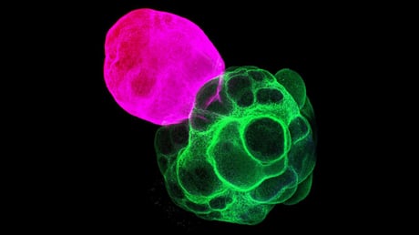 Az agy vezérlőközpontja végre megszületett a laborban