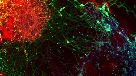 Az agyfejlődés titkai: génvadászat leplezi le az idegsejtek születését