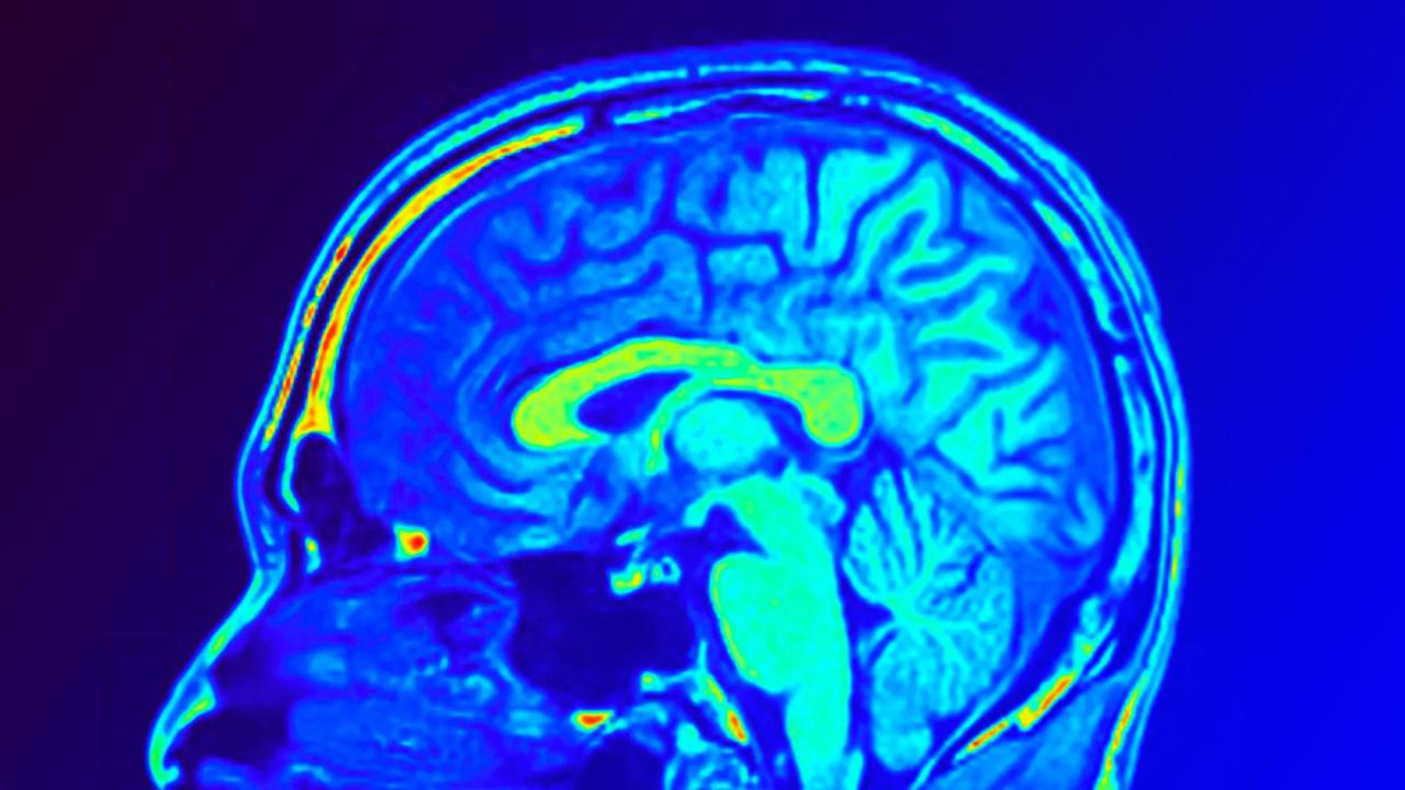 Az agyi MRI új korszakot nyithat a depresszió gyógyításában