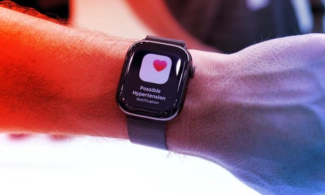 Az Apple Watch már a magas vérnyomásra is riaszt – így kapcsolod be