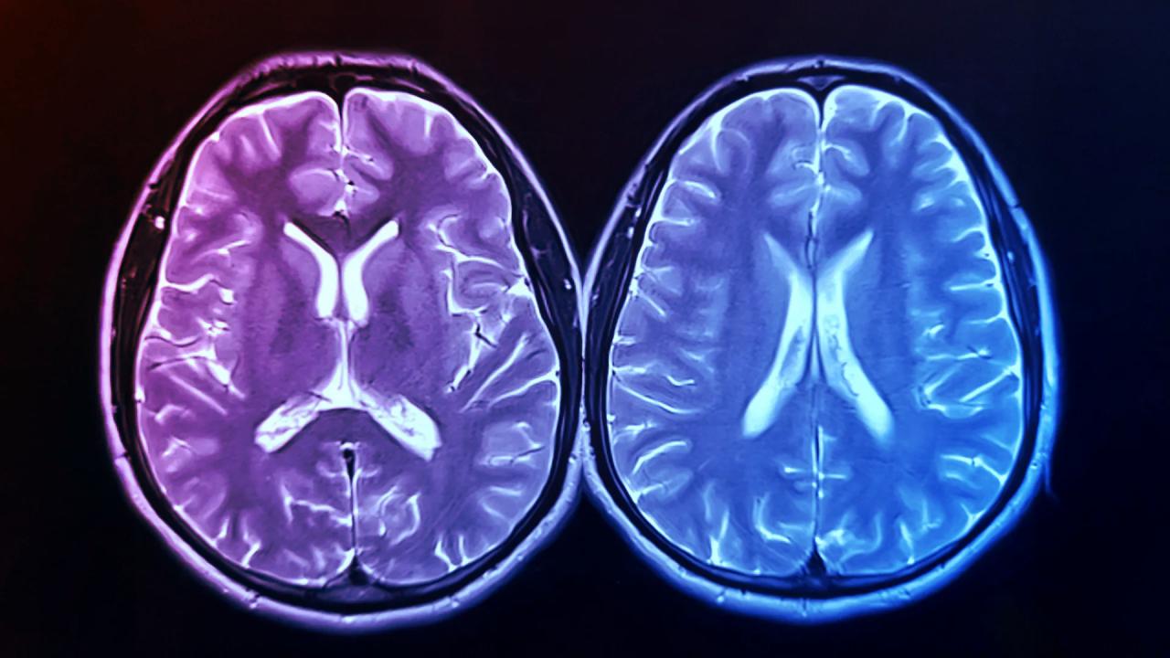 Az edzés éveket faraghat le az agy korából