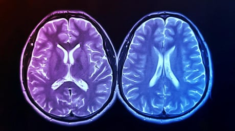 Az edzés éveket faraghat le az agy korából