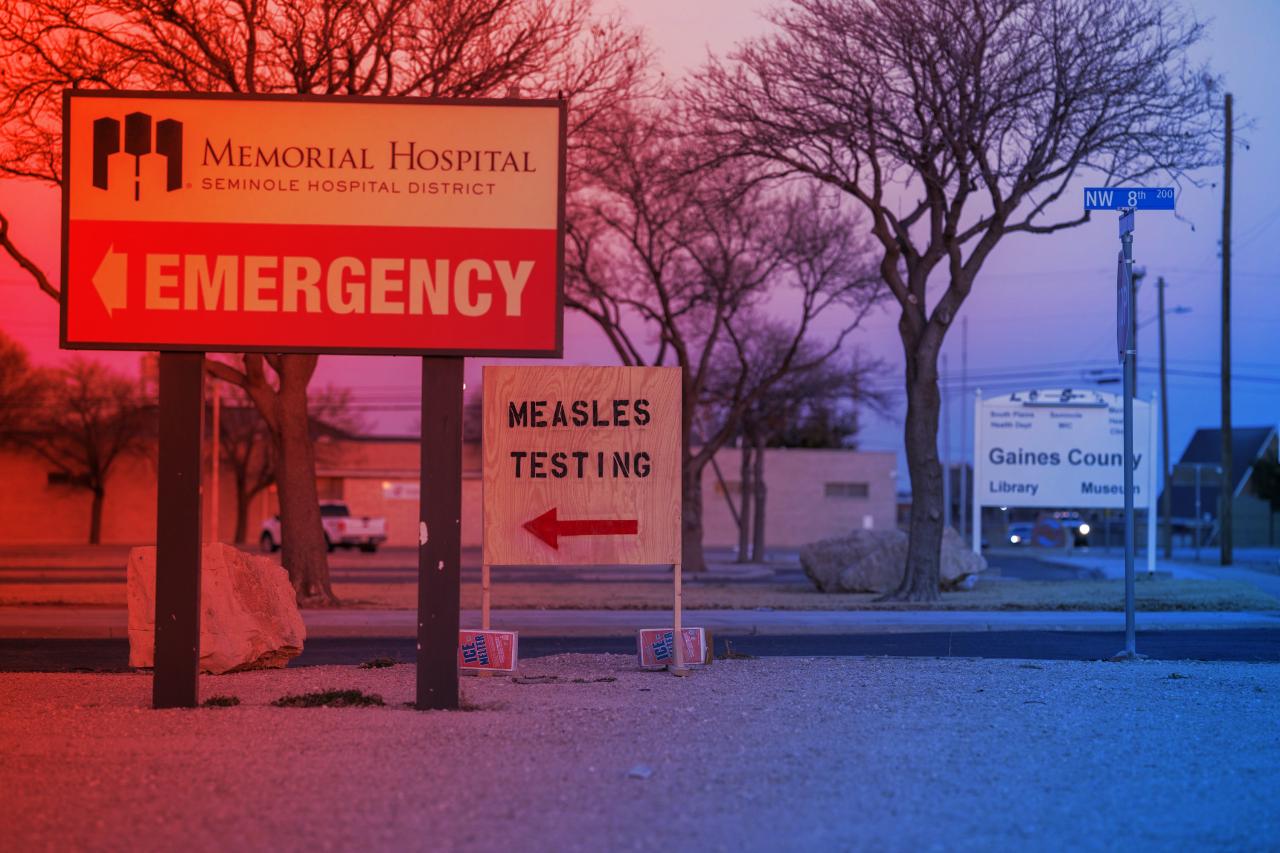 Az Egyesült Államokban ismét kitörhet a kanyarójárvány