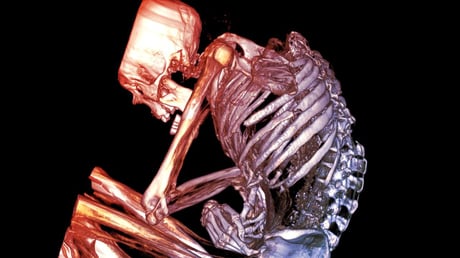 Az ezeréves chilei múmia rejtélye: halál a türkizbányában