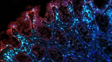 Az öregedő belek fiatalítása: áttörés a sejtes immunterápiában