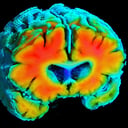 A rejtett szikra az Alzheimer mögött: láthatatlan vérellátási zavar