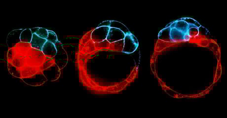 A repedések ereje: így alakulnak a szövetek és szervek