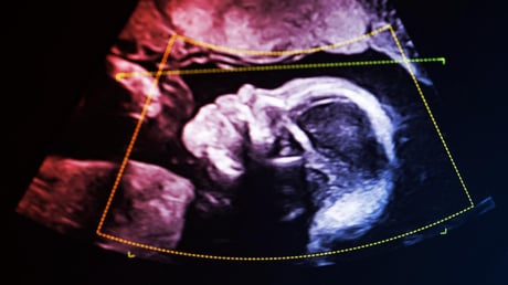 Amikor a DNS cáfolja az anyaságot: becsap a genetika