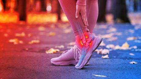 Az Achilles-ín fájdalmának rejtett oka végre leleplezve