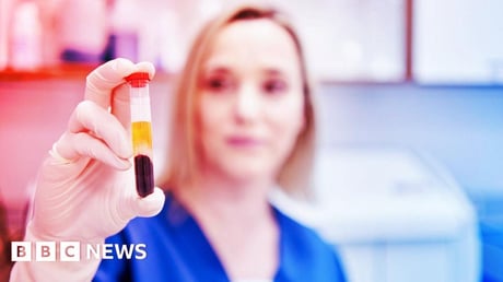 Az áttörés elmaradt: az új daganatteszt csalódást hozott az NHS-ben