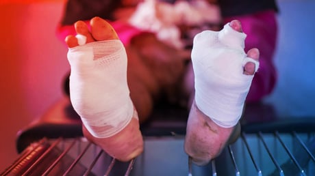 Az oxigénzselé forradalmasíthatja a cukorbetegek sebgyógyulását